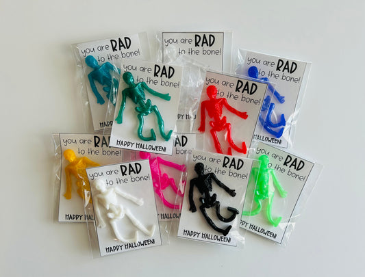 RAD to the BONE Skeletons!